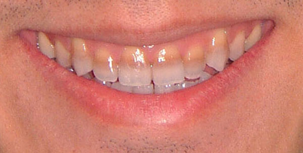 Case 4 — Cosmetic Reconstruction — before